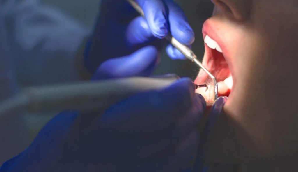 “Rapito perché non vuole andare dal dentista” I La storia di un dodicenne ha catturato il cuore degli utenti